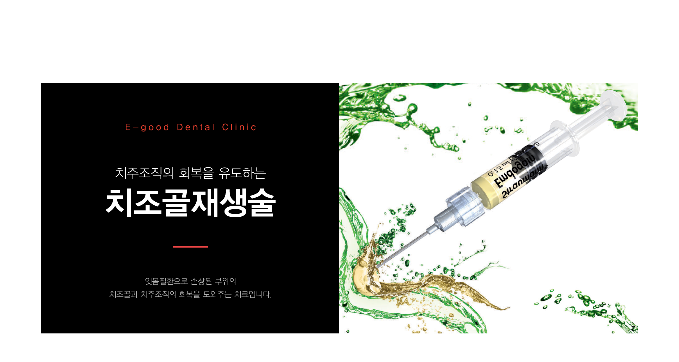 ġ Ʈ츸 